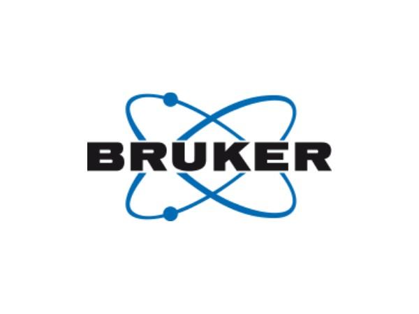 Bruker Corporation (NASDAQ:BRKR) Financial Performance and Outlook